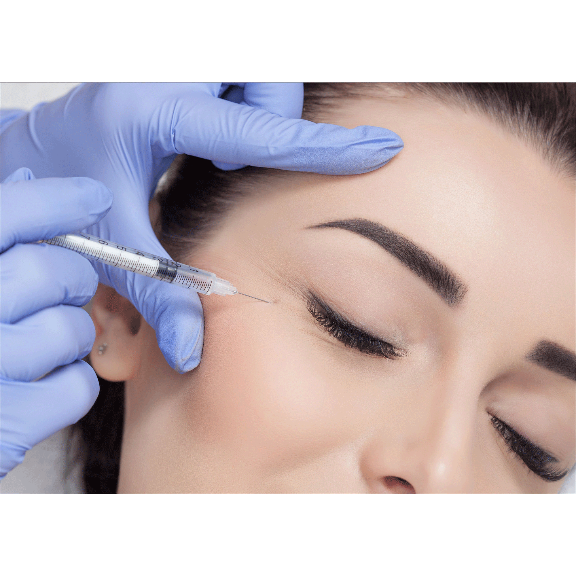 Eye Fillers – Beauty Fix MedSpa