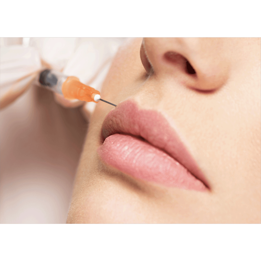 Lip Filler – Beauty Fix MedSpa