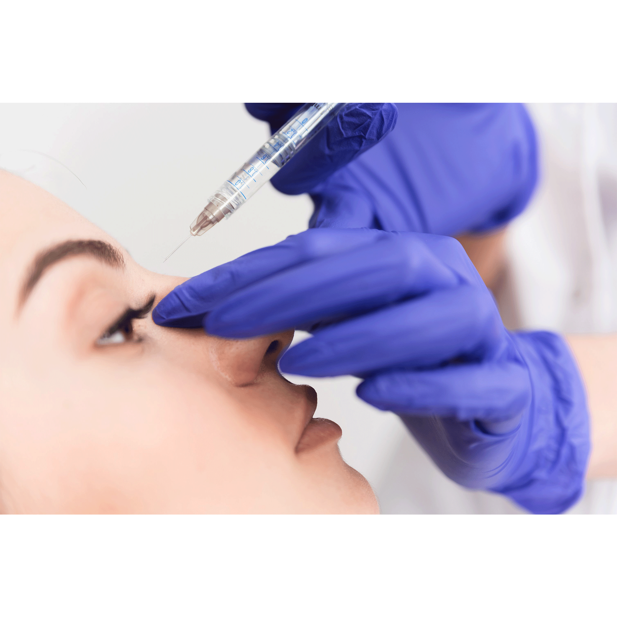 Nose Filler – Beauty Fix MedSpa