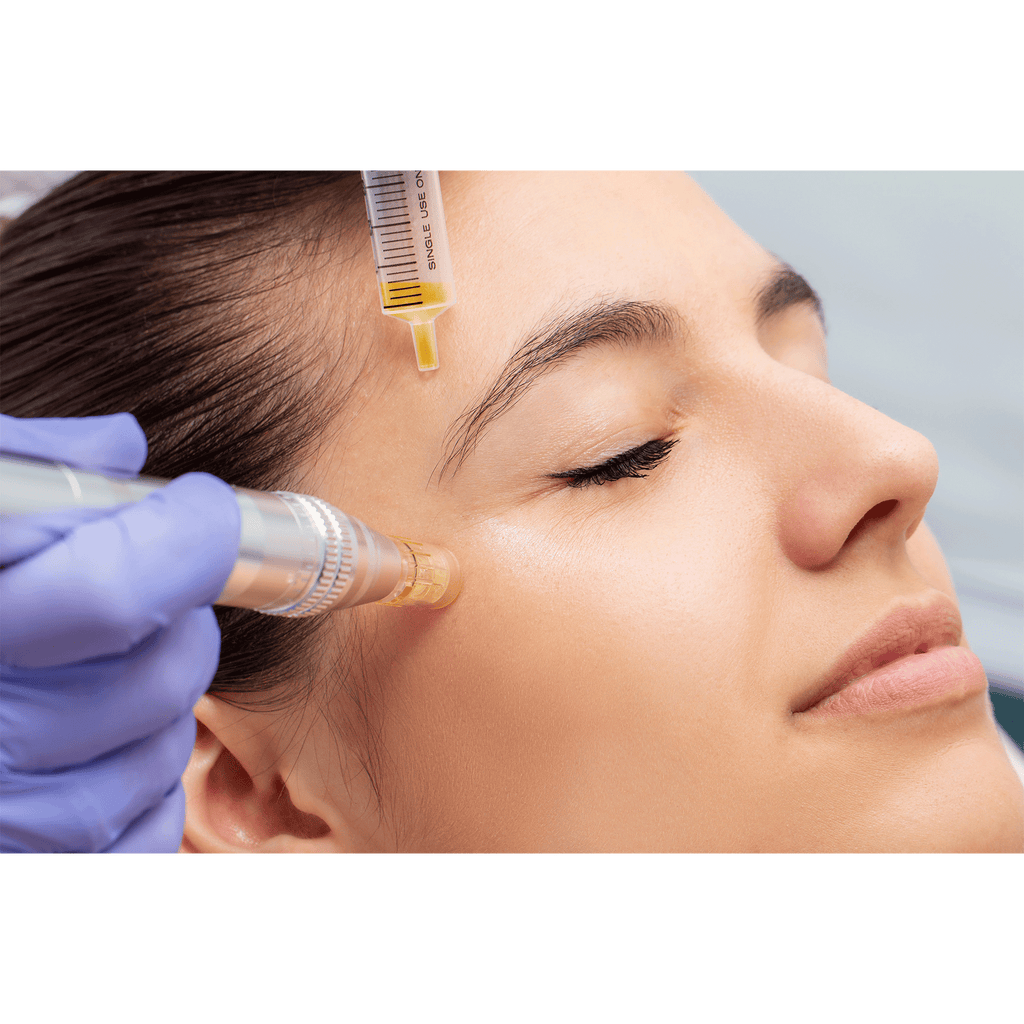 SkinPen (Microneedling) – Beauty Fix MedSpa